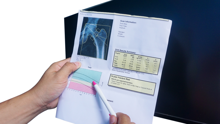 Osteoporosis results sheet