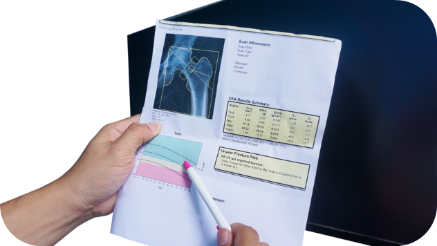 DEXA Results