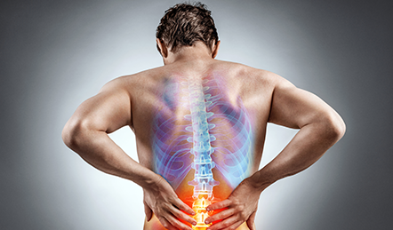 Back pain and sciatica