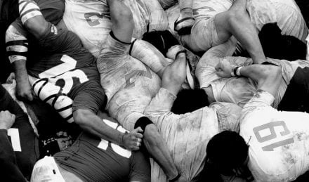 Rugby injuries