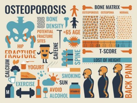 Osteoporosis Symptoms and Risks