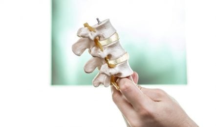 Back pain and surgery