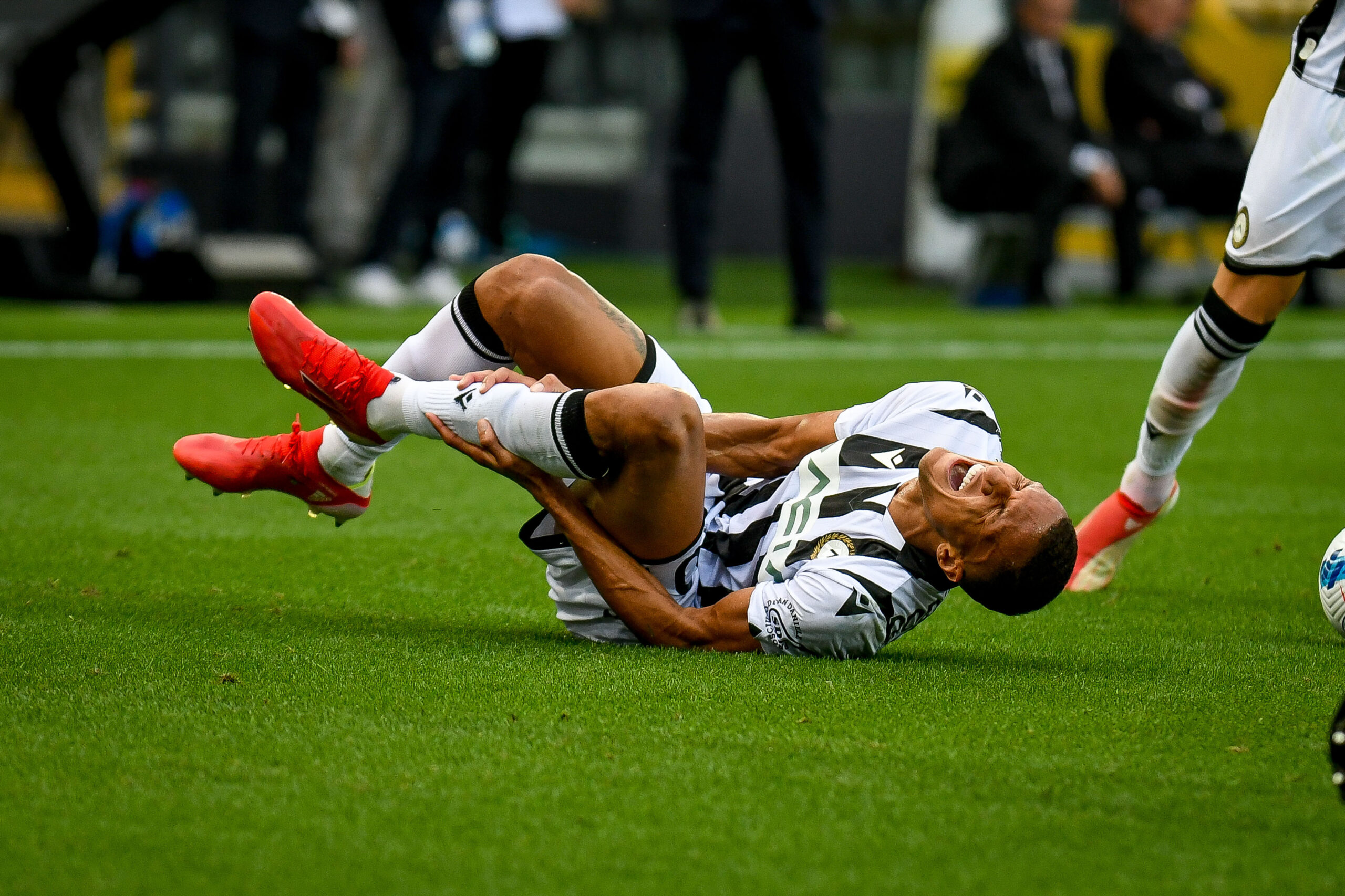 Football injuries